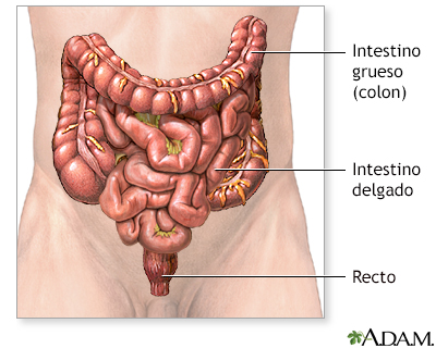 Cáncer de colon - serie