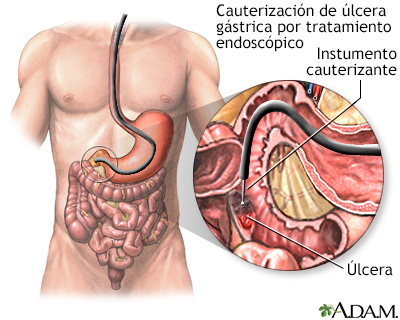 Procedimiento (segunda parte)