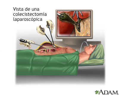 Procedimiento (segunda parte)