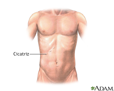 Cuidados postoperatorios