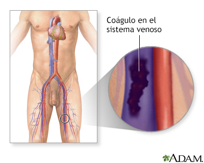 Indicaciones