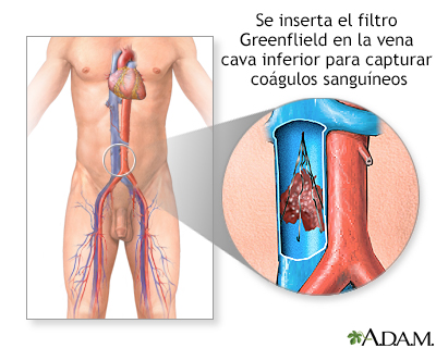 Procedimiento (segunda parte)