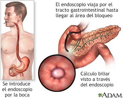 Procedimiento (parte 1)