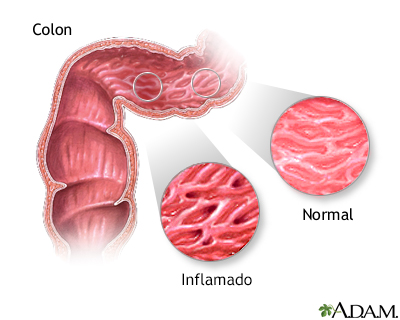 Indicaciones