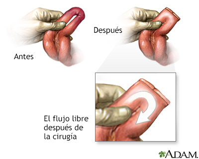 Cuidados postoperatorios