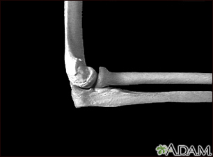 Codo - vista lateral