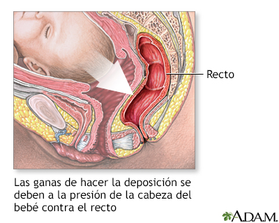 Parto de emergencia