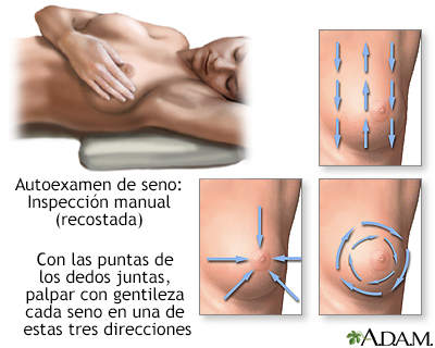 Autoexamen de seno