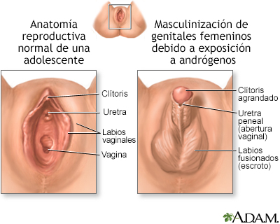 Trastornos en el desarrollo de la vagina y la vulva