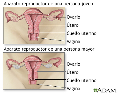 Menopausia