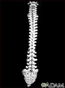 Columna vertebral