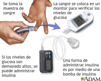 Examen de glucosa