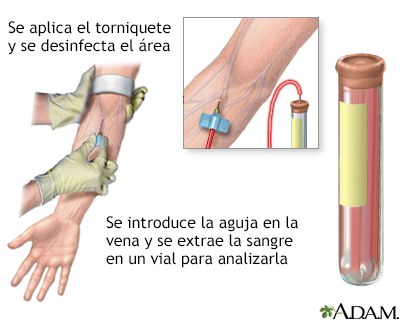 Examen de sangre PSA