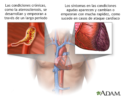 Condiciones agudas contra crónicas