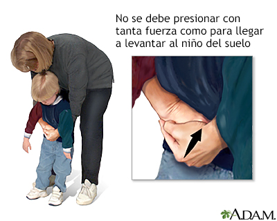 Maniobra de Heimlich en niños conscientes