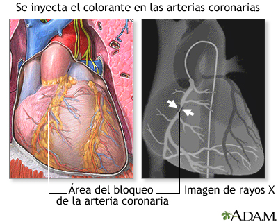 Procedimiento (segunda parte)