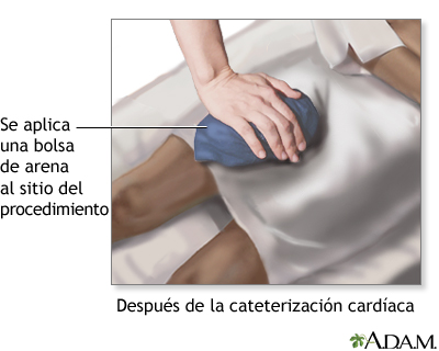 Cuidados postoperatorios (segunda parte)