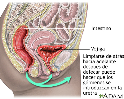 Prevención de la cistitis