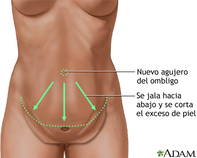 Procedimiento (tercera parte)