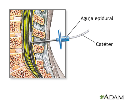 Procedimiento (cuarta parte)