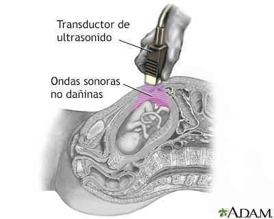 Ecografía prenatal - serie - Procedimiento (segunda parte)