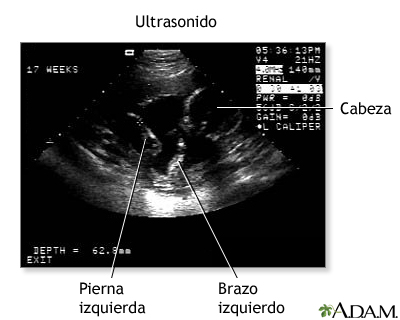 Ecografía prenatal - serie - Procedimiento (tercera parte)