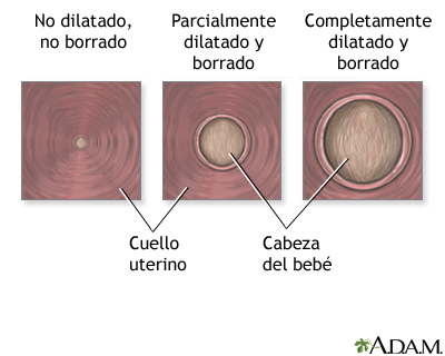 Procedimiento (tercera parte)