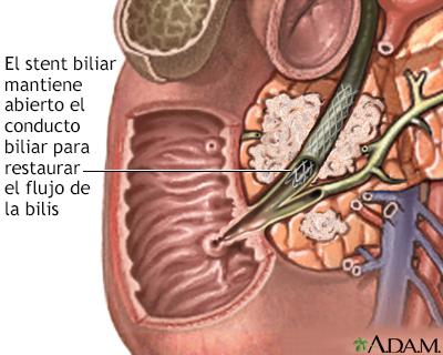 Cuidados postoperatorios