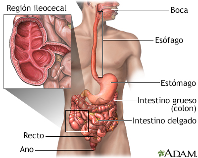 Enfermedad de Crohn - áreas afectadas