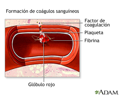 Formación de coágulos sanguíneos