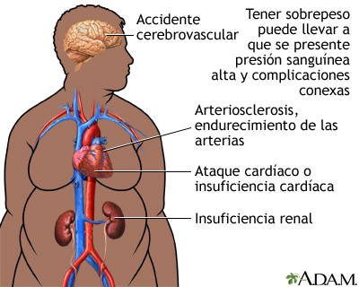 Obesidad y salud