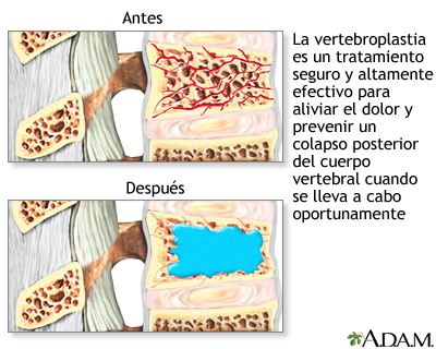 Cuidados postoperatorios