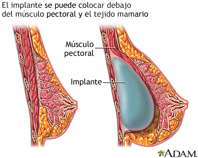 Procedimiento (segunda parte)