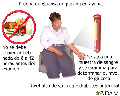 Prueba de glucosa en plasma en ayunas