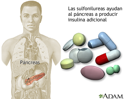 Drogas sulfonilureas