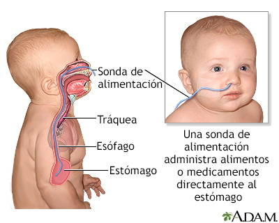 Sonda de alimentación