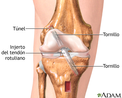 Procedimiento (segunda parte)