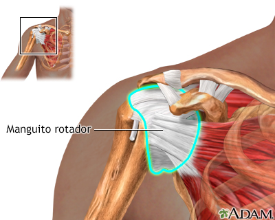 Reparación del manguito de los rotadores - serie - Manguito rotador normal