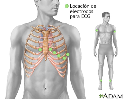 Colocación de electrodos para ECG