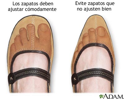 Zapato de ajuste apropiado