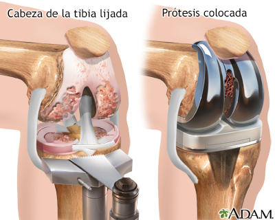 Procedimiento