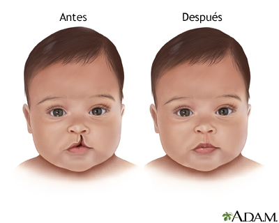 Cuidados postoperatorios