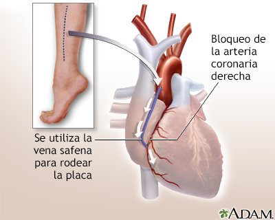 Procedimiento (segunda parte)