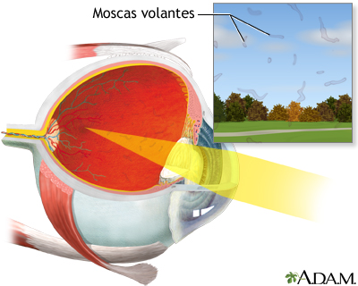 Moscas volantes