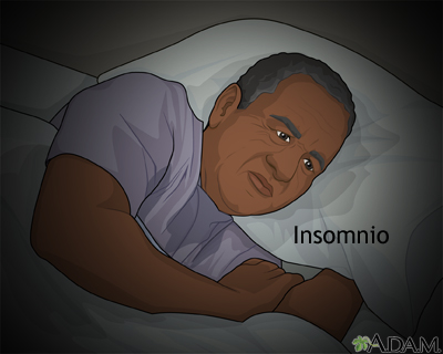 Depresión e insomnio