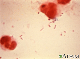 Organismo Haemophilus influenza