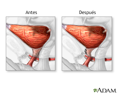 Cuidados postoperatorios