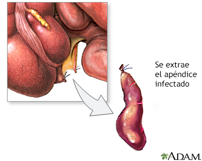 Procedimiento