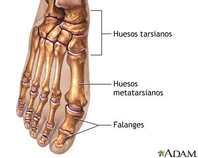 Extirpación del juanete - Serie