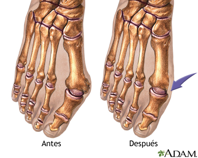 Cuidados postoperatorios